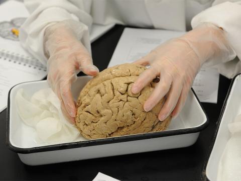 Student wearing gloves, holding a brain in a dissection tray.